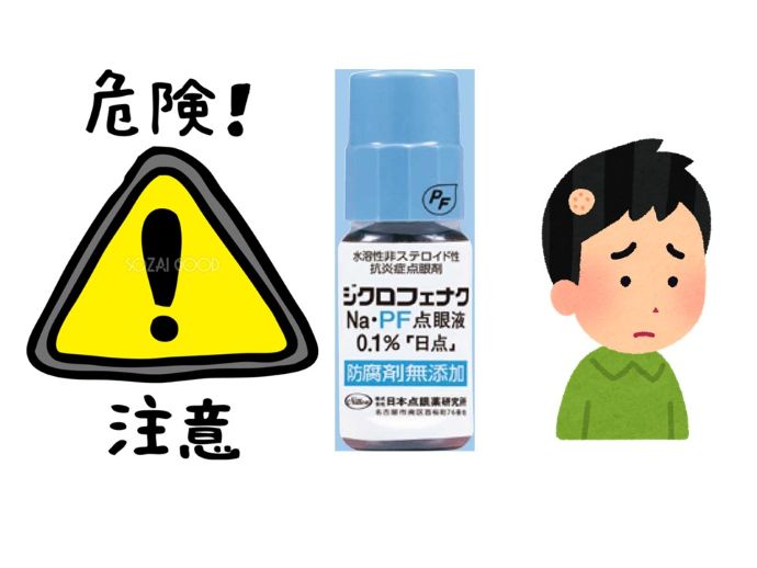 円形脱毛症　病院